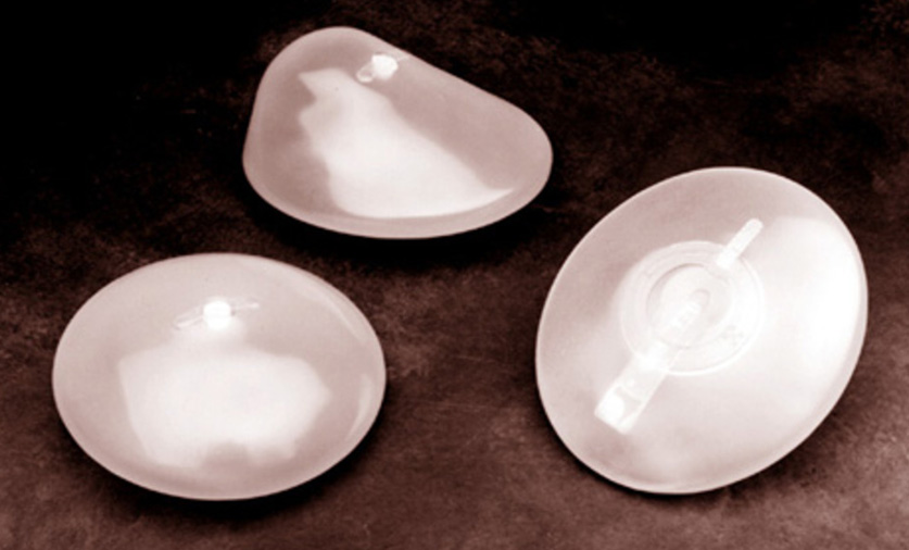 breast implant revision