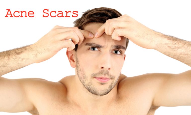 The Evolution Of Acne Scar Removal Technology Newman Plastic Surgery